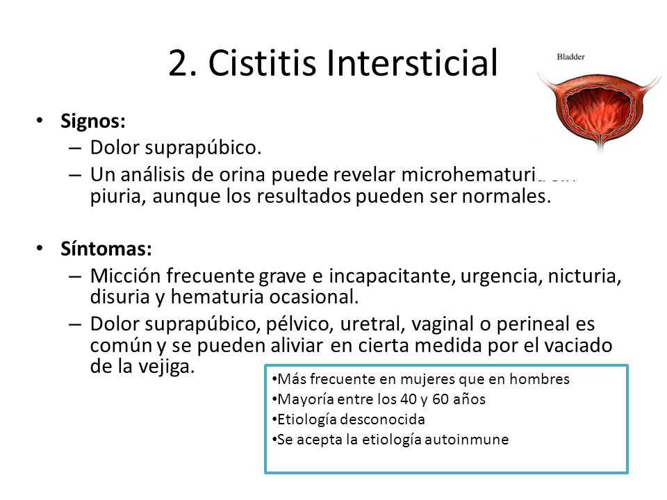 causas de cistitis cronica en mujeres